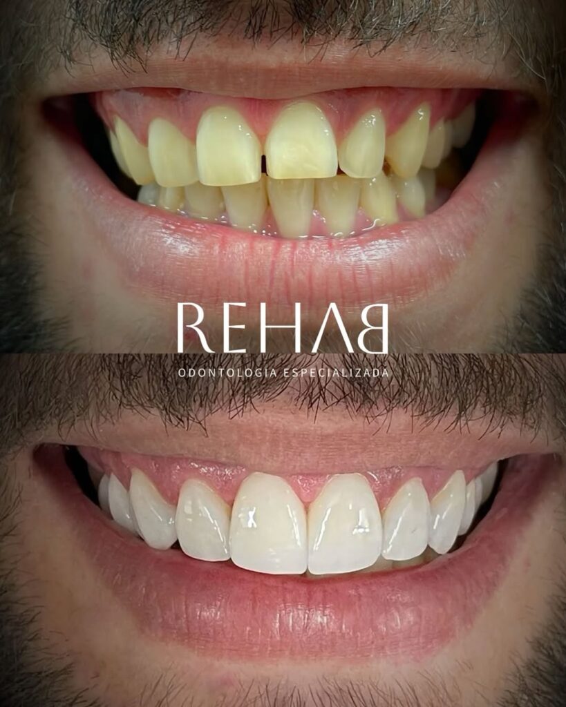 E3c3EjewnxGhFvK4FrsZV20Xik