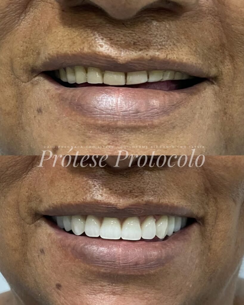 lDHZfLReStnOe5g2yWDlpGGOu1Y