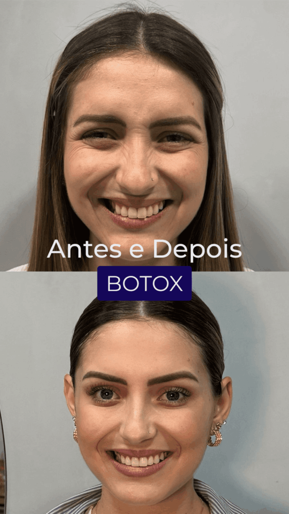 mzV30aleIRF8n3MXQTfAL3lPCiQ